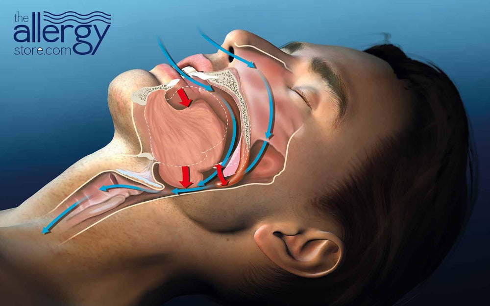 Unmasking the Mystery: Why Do I Snore?